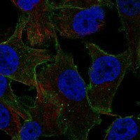 Immunofluorescent staining of human cell line SK-MEL-30 shows localization to plasma membrane & vesicles.