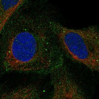 Immunofluorescent staining of human cell line U-2 OS shows localization to plasma membrane, cytosol & vesicles.