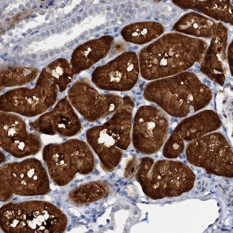 Immunohistochemical staining of human kidney shows strong cytoplasmic positivity in tubular cells.