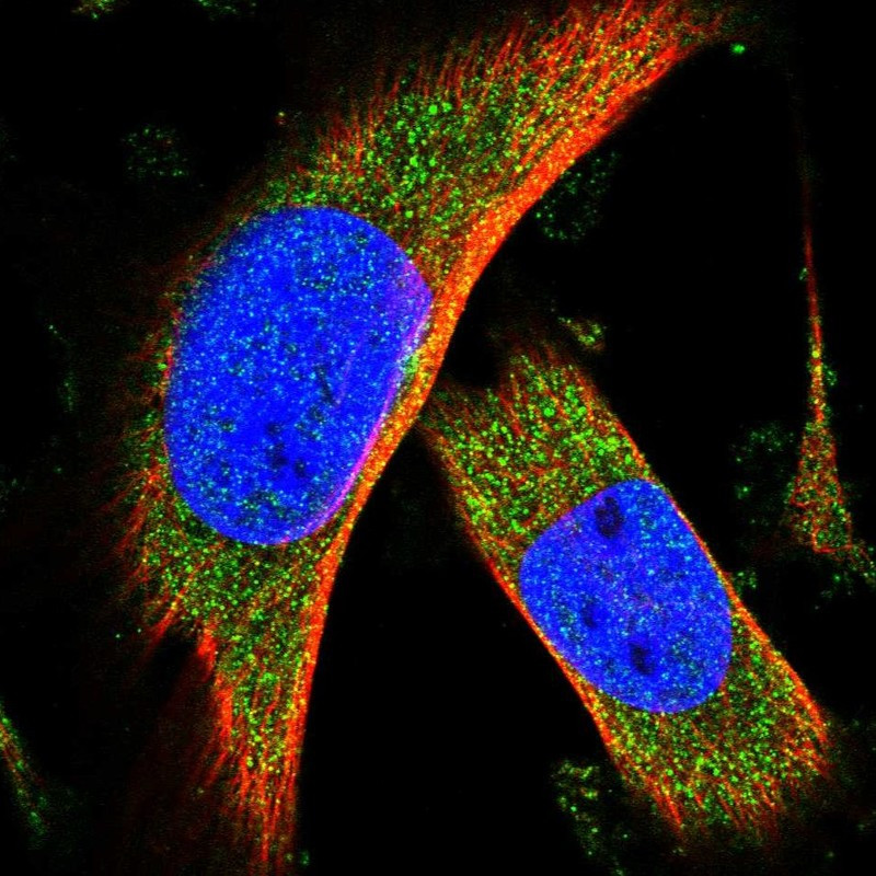 Immunofluorescent staining of human cell line U-251 MG shows localization to cytosol.