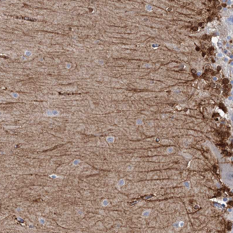 Immunohistochemical staining of human stomach shows strong cytoplasmic positivity in glandular cells.
