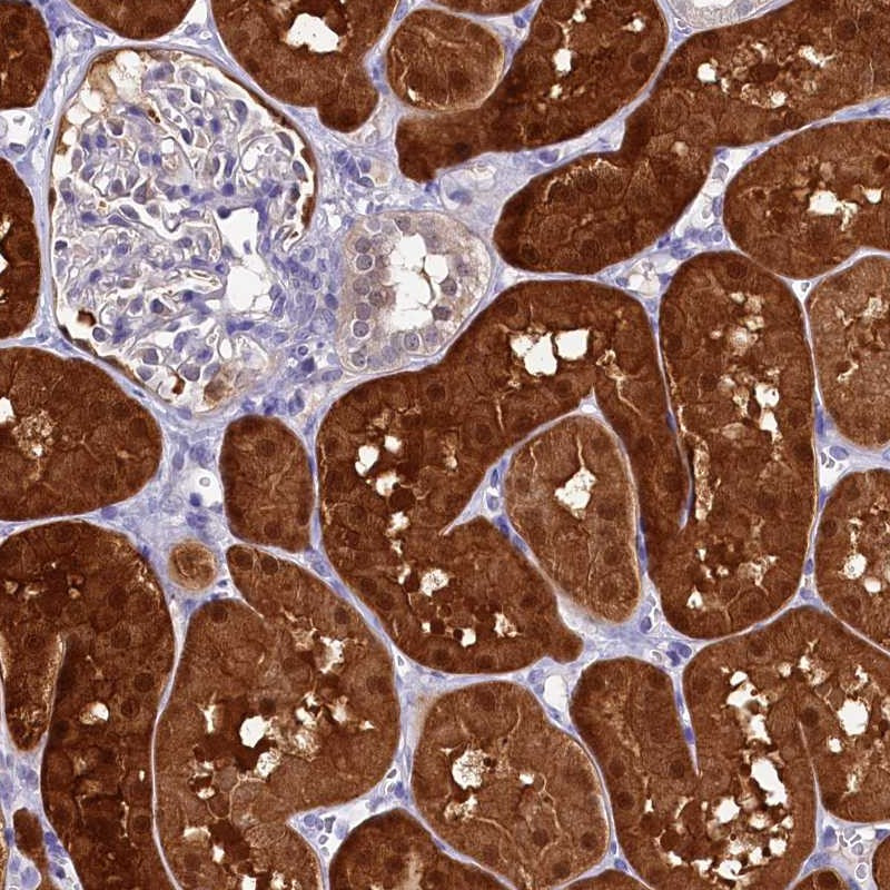 Immunohistochemical staining of human kidney shows strong cytoplasmic and nuclear positivity in cells in tubules.
