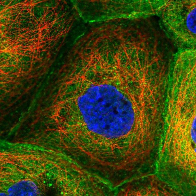 Immunofluorescent staining of human cell line A-431 shows localization to plasma membrane & cytosol.