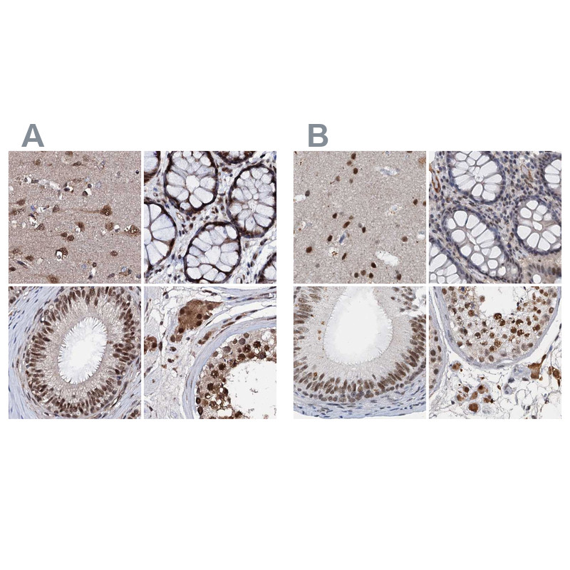 Immunohistochemical staining of human cerebral cortex, colon, epididymis and testis using Anti-CSTF3 antibody HPA040168 (A) shows similar protein distribution across tissues to independent antibody HPA039743 (B).