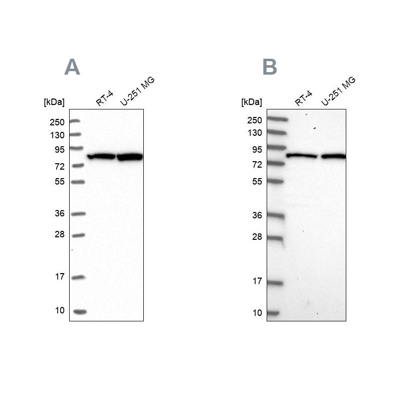 Western blot analysis using Anti-CSTF3 antibody HPA040168 (A) shows similar pattern to independent antibody HPA039743 (B).