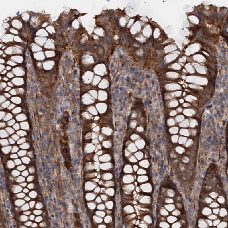 Immunohistochemical staining of human colon shows strong cytoplasmic and membranous positivity in glandular cells.
