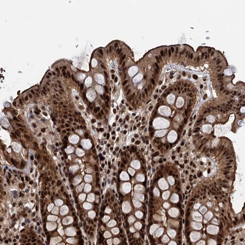 Immunohistochemical staining of human colon shows strong nuclear, cytoplasmic and membranous positivity in glandular cells.