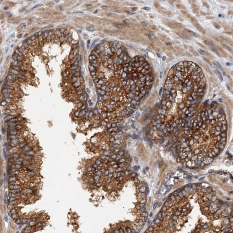 Immunohistochemical staining of human prostate shows strong cytoplasmic positivity in glandular cells.