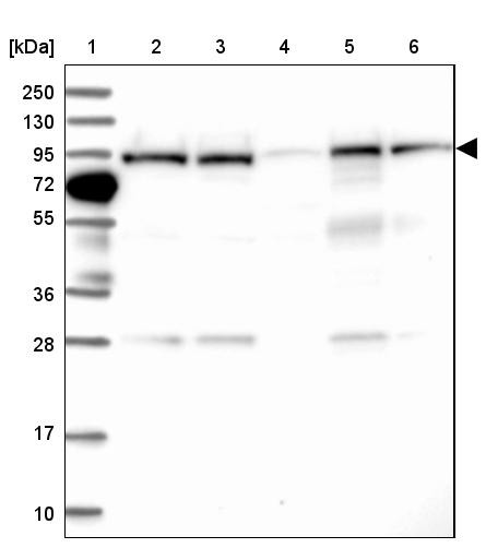 Lane 1: Marker [kDa] 250, 130, 95, 72, 55, 36, 28, 17, 10<br/>Lane 2: Human cell line RT-4<br/>Lane 3: Human cell line U-251MG sp<br/>Lane 4: Human plasma (IgG/HSA depleted)<br/>Lane 5: Human liver tissue<br/>Lane 6: Human tonsil tissue