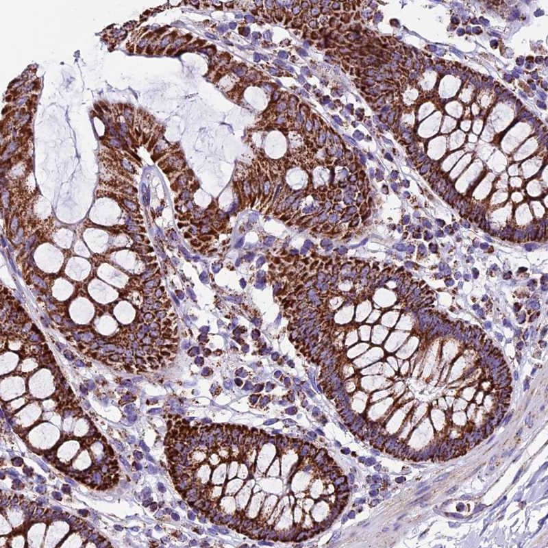 Immunohistochemical staining of human colon shows strong cytoplasmic positivity with granular pattern in glandular cells.