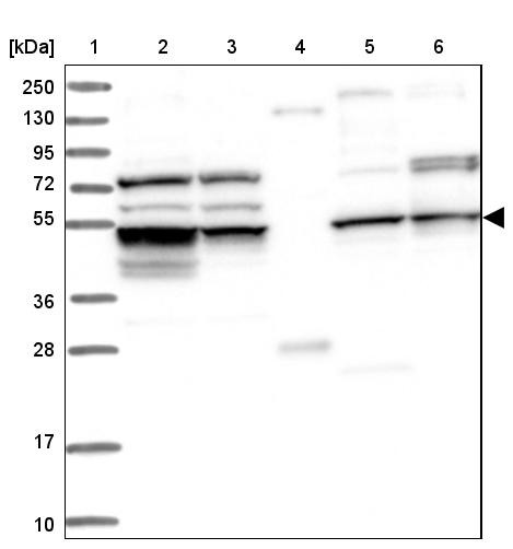 Lane 1: Marker [kDa] 250, 130, 95, 72, 55, 36, 28, 17, 10<br/>Lane 2: Human cell line RT-4<br/>Lane 3: Human cell line U-251MG sp<br/>Lane 4: Human plasma (IgG/HSA depleted)<br/>Lane 5: Human liver tissue<br/>Lane 6: Human tonsil tissue