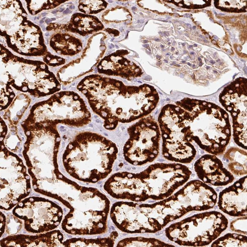 Immunohistochemical staining of human kidney shows strong cytoplasmic positivity in cells in tubules.