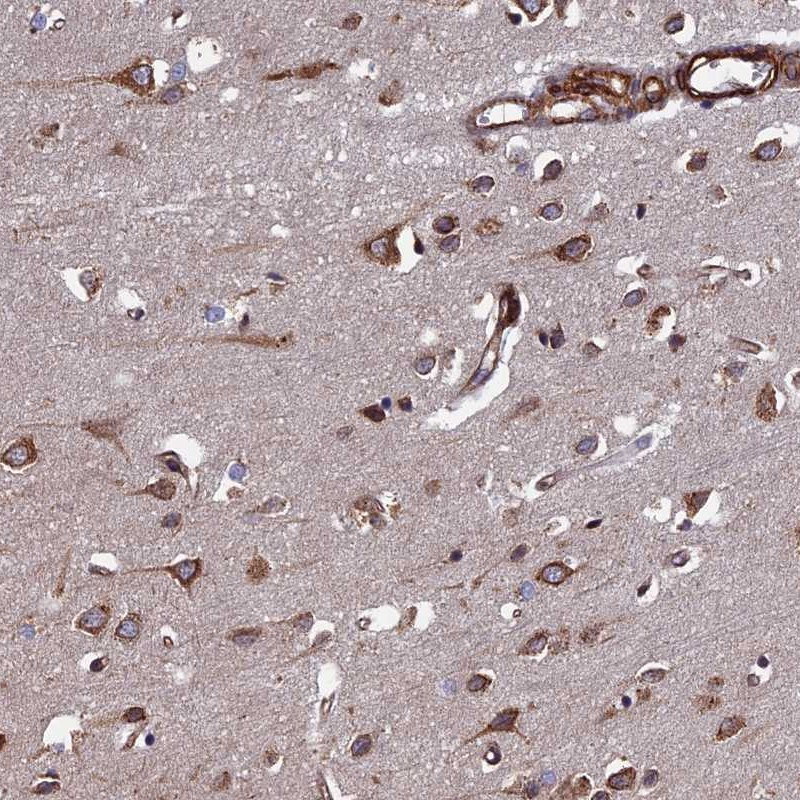 Immunohistochemical staining of human cerebral cortex shows strong positivity in neuronal cells.