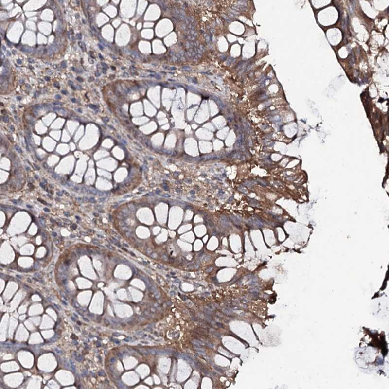 Immunohistochemical staining of human colon shows moderate cytoplasmic positivity in glandular cells.