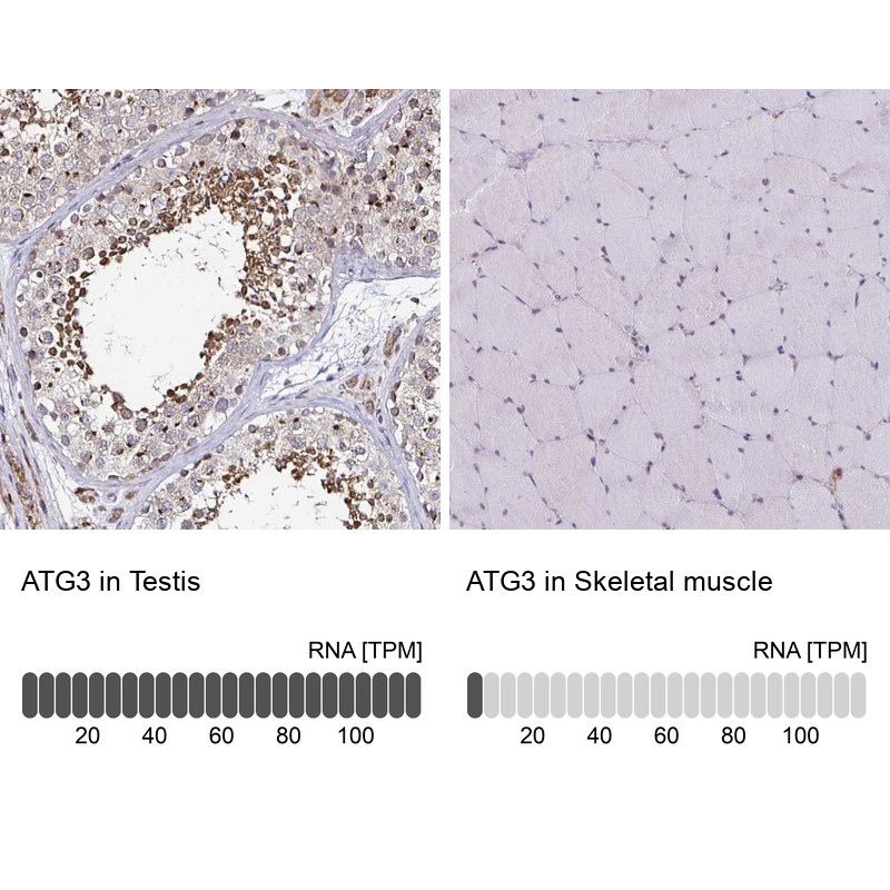Immunohistochemistry analysis in human testis and skeletal muscle tissues using Anti-ATG3 antibody. Corresponding ATG3 RNA-seq data are presented for the same tissues.