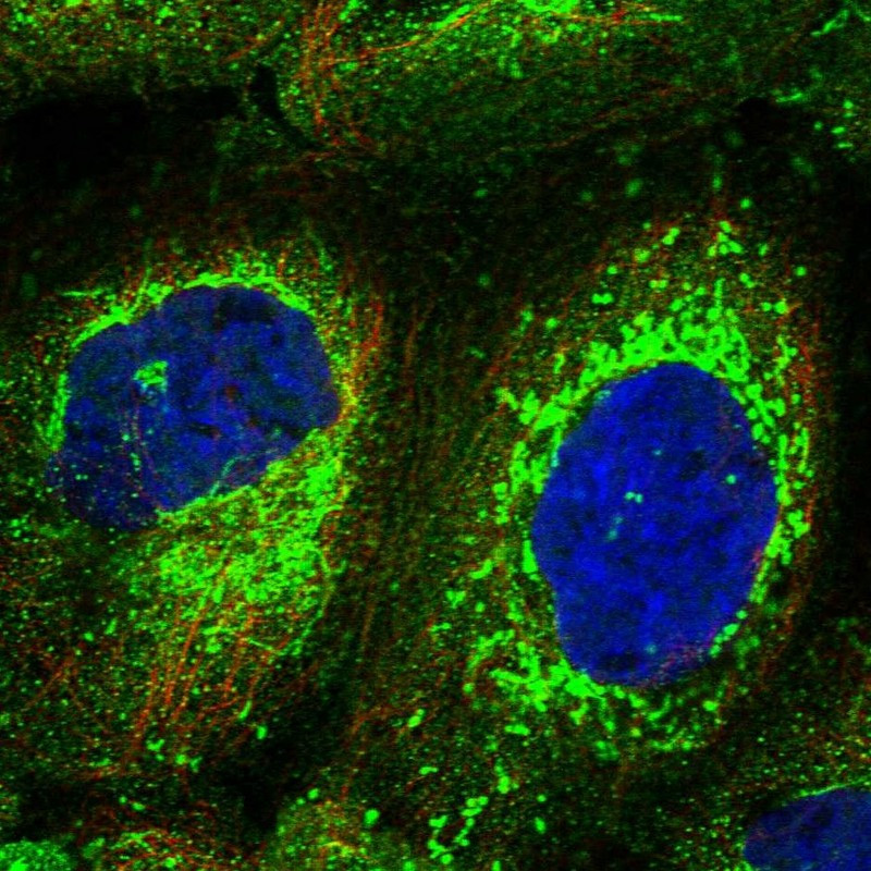 Immunofluorescent staining of human cell line A-431 shows localization to cytosol & mitochondria.