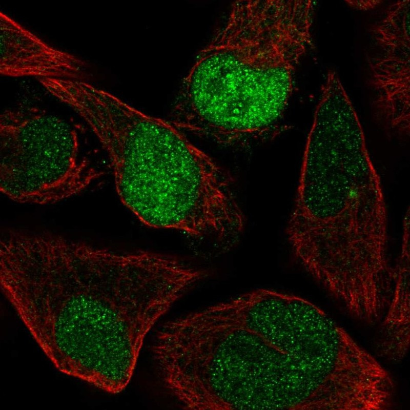 Immunofluorescent staining of human cell line RH-30 shows localization to nucleoplasm.
