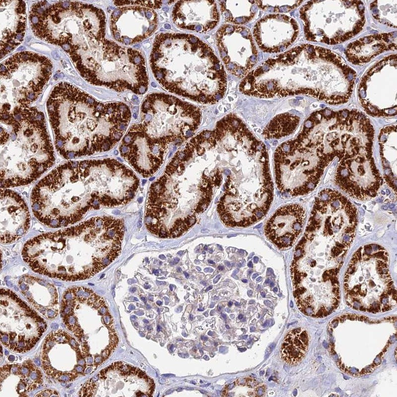 Immunohistochemical staining of human kidney shows strong cytoplasmic positivity in cells in tubules.