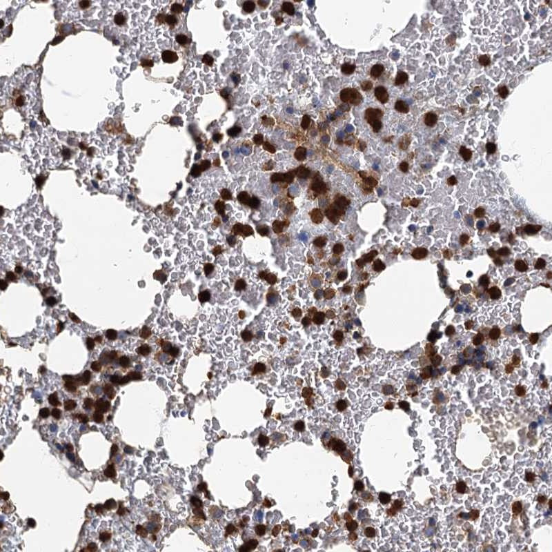 Immunohistochemical staining of human bone marrow shows strong cytoplasmic positivity in bone marrow poietic cells.