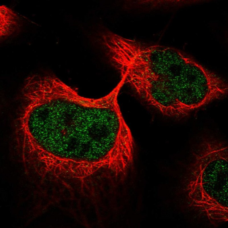 Immunofluorescent staining of human cell line U-2 OS shows localization to nucleoplasm.