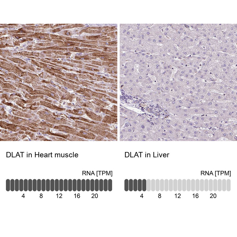 Immunohistochemistry analysis in human heart muscle and liver tissues using Anti-DLAT antibody. Corresponding DLAT RNA-seq data are presented for the same tissues.