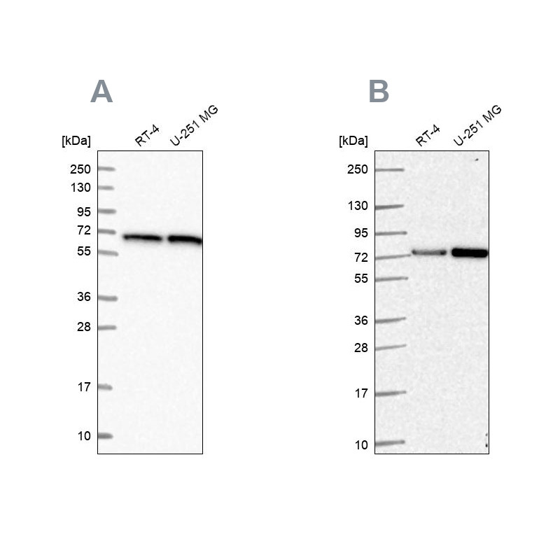 Western blot analysis using Anti-DLAT antibody HPA040786 (A) shows similar pattern to independent antibody HPA062766 (B).