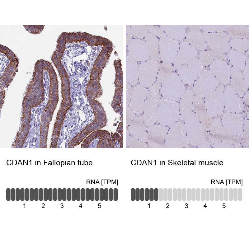 Immunohistochemistry analysis in human fallopian tube and skeletal muscle tissues using HPA040787 antibody. Corresponding CDAN1 RNA-seq data are presented for the same tissues.