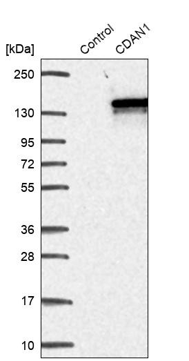 Western blot analysis in control (vector only transfected HEK293T lysate) and CDAN1 over-expression lysate (Co-expressed with a C-terminal myc-DDK tag (~3.1 kDa) in mammalian HEK293T cells, LY408581).