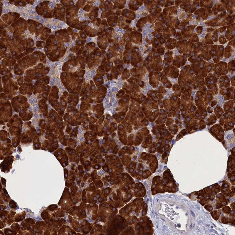 Immunohistochemical staining of human pancreas shows strong cytoplasmic positivity in exocrine glandular cells.