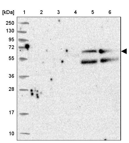 Lane 1: Marker [kDa] 250, 130, 95, 72, 55, 36, 28, 17, 10<br/>Lane 2: Human cell line RT-4<br/>Lane 3: Human cell line U-251MG sp<br/>Lane 4: Human plasma (IgG/HSA depleted)<br/>Lane 5: Human liver tissue<br/>Lane 6: Human tonsil tissue