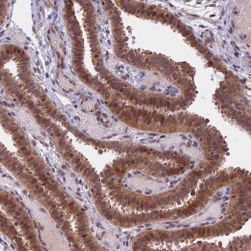 Immunohistochemical staining of human fallopian tube shows moderate nuclear and cytoplasmic positivity in glandular cells.