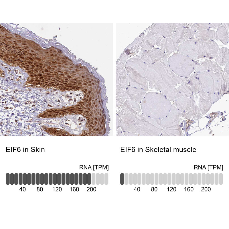 Immunohistochemistry analysis in human skin and skeletal muscle tissues using HPA040873 antibody. Corresponding EIF6 RNA-seq data are presented for the same tissues.