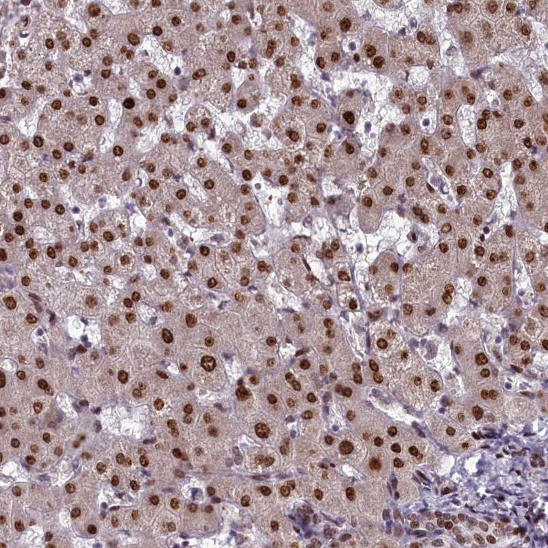 Immunohistochemical staining of human liver shows strong nuclear positivity in hepatocytes.