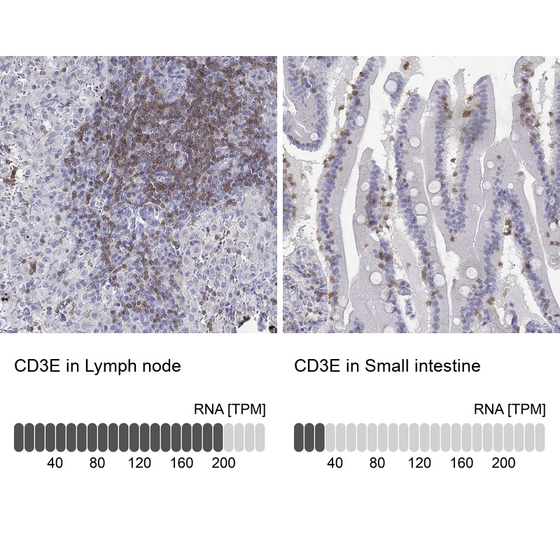 Immunohistochemistry analysis in human lymph node and small intestine tissues using HPA040957 antibody. Corresponding CD3E RNA-seq data are presented for the same tissues.