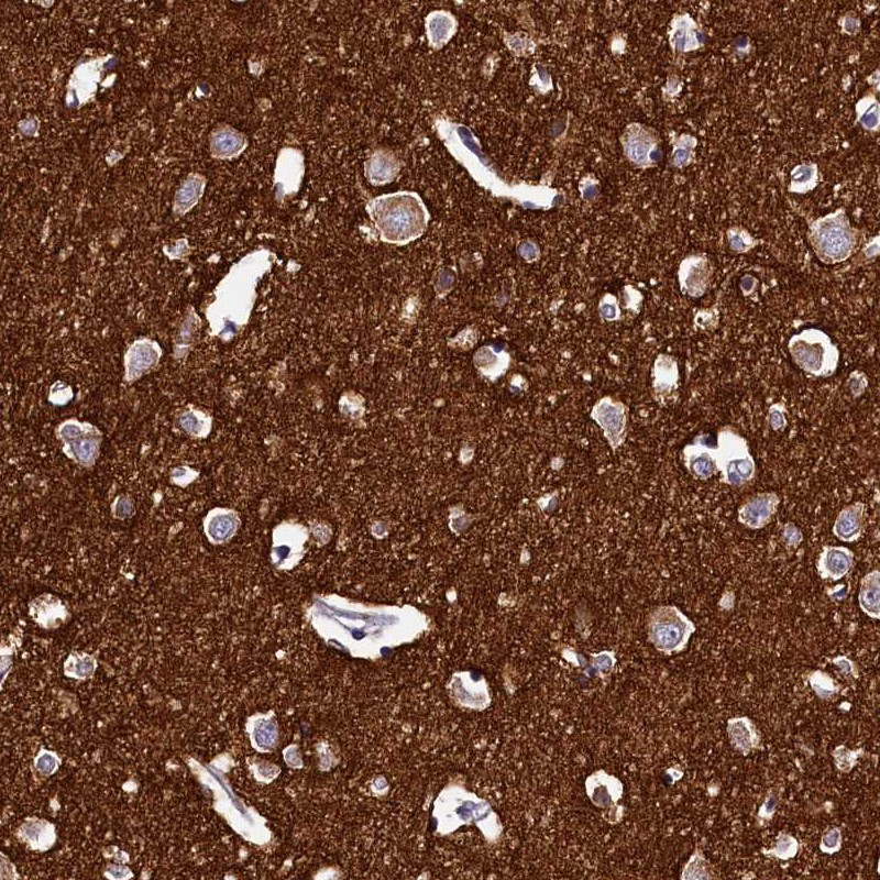 Immunohistochemical staining of human cerebral cortex shows moderate cytoplasmic positivity in neuronal cells.