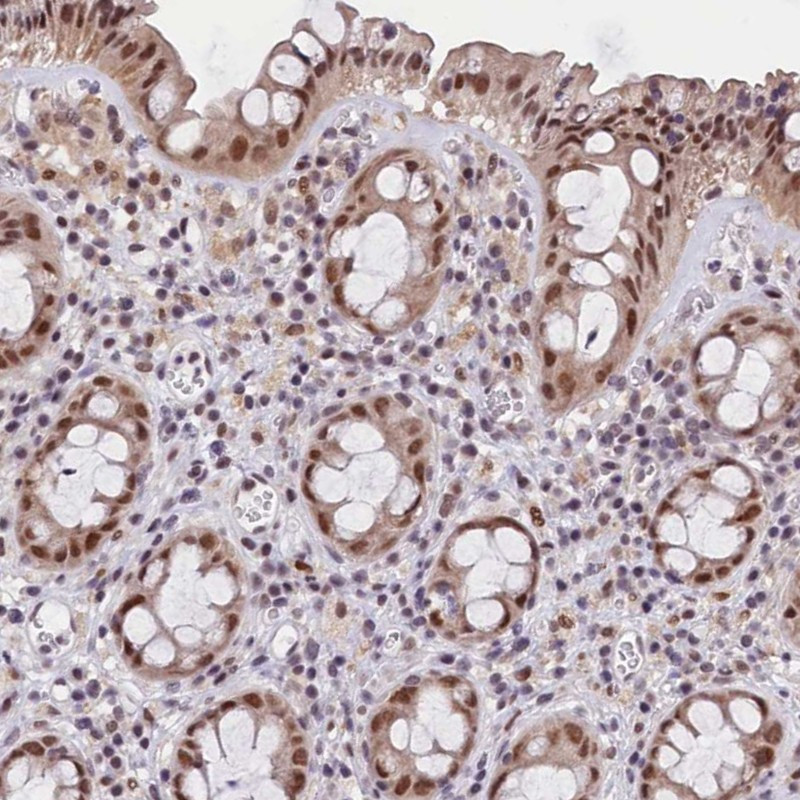 Immunohistochemical staining of human rectum shows moderate nuclear positivity in glandular cells.