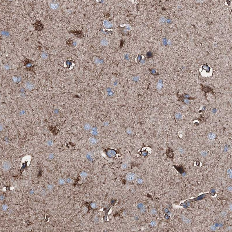 Immunohistochemical staining of human cerebral cortex shows strong cytoplasmic positivity in glial cells.