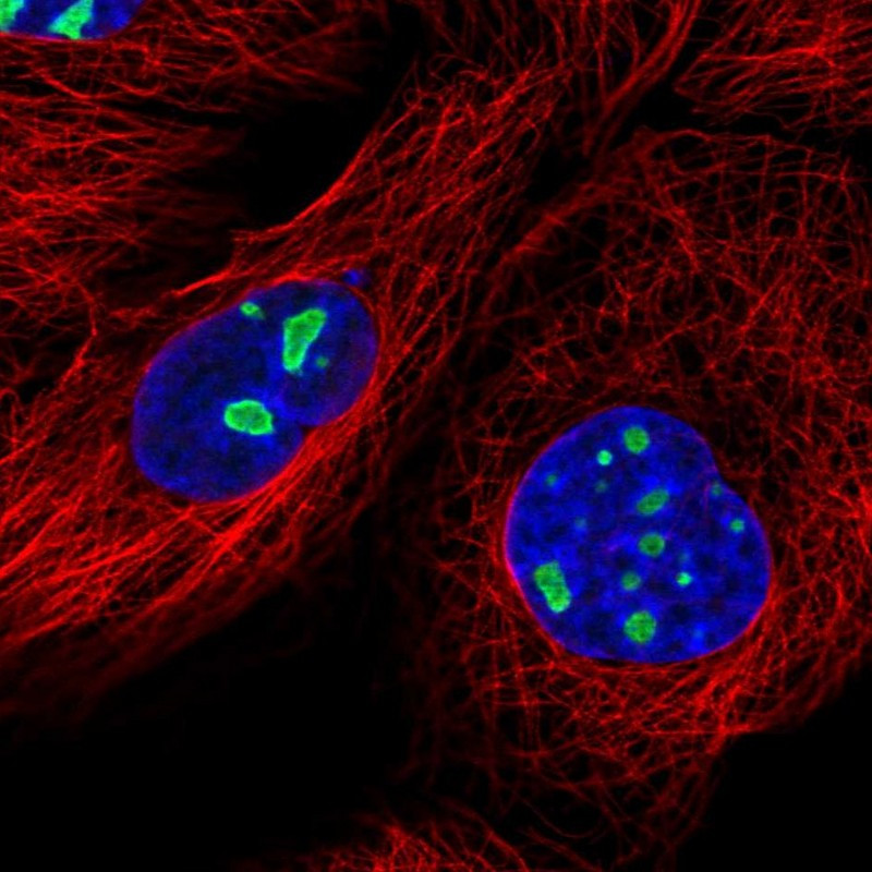 Immunofluorescent staining of human cell line A-431 shows localization to nucleoli.