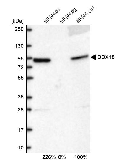 Western blot analysis in U2OS cells transfected with control siRNA, target specific siRNA probe #1 and #2, using Anti-DDX18 antibody. Remaining relative intensity is presented.