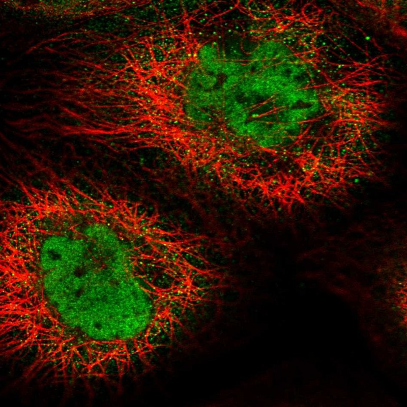 Immunofluorescent staining of human cell line A-431 shows localization to nucleoplasm & cytosol.