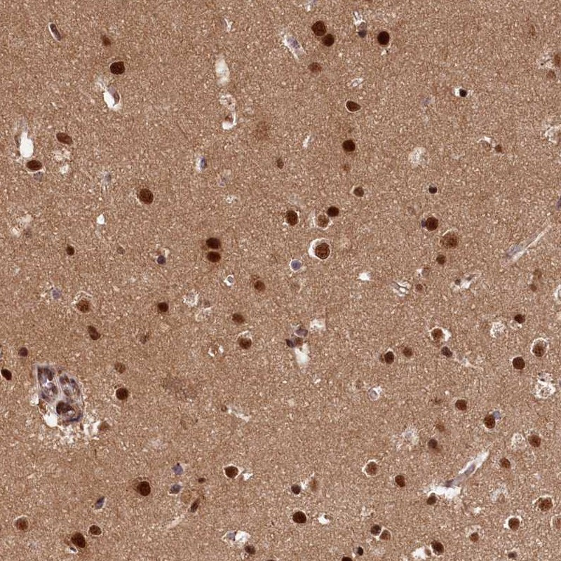 Immunohistochemical staining of human cerebral cortex shows strong nuclear positivity in glial cells.