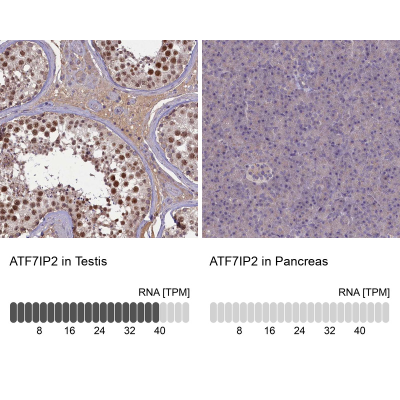 Immunohistochemistry analysis in human testis and pancreas tissues using Anti-ATF7IP2 antibody. Corresponding ATF7IP2 RNA-seq data are presented for the same tissues.