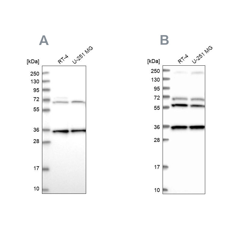 Western blot analysis using Anti-DNAJC17 antibody HPA041187 (A) shows similar pattern to independent antibody HPA040914 (B).