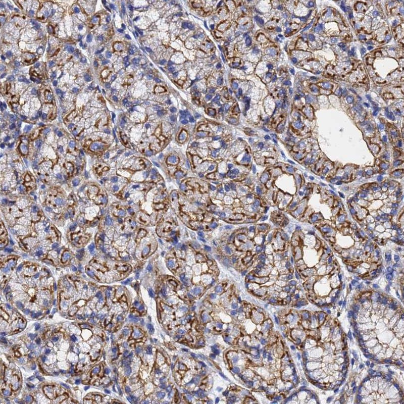 Immunohistochemical staining of human stomach, upper shows strong membranous positivity in glandular cells.