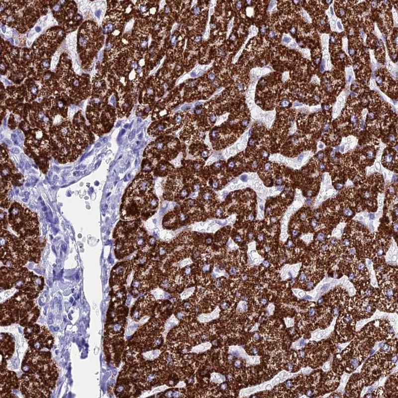 Immunohistochemical staining of human liver shows strong cytoplasmic positivity in hepatocytes.