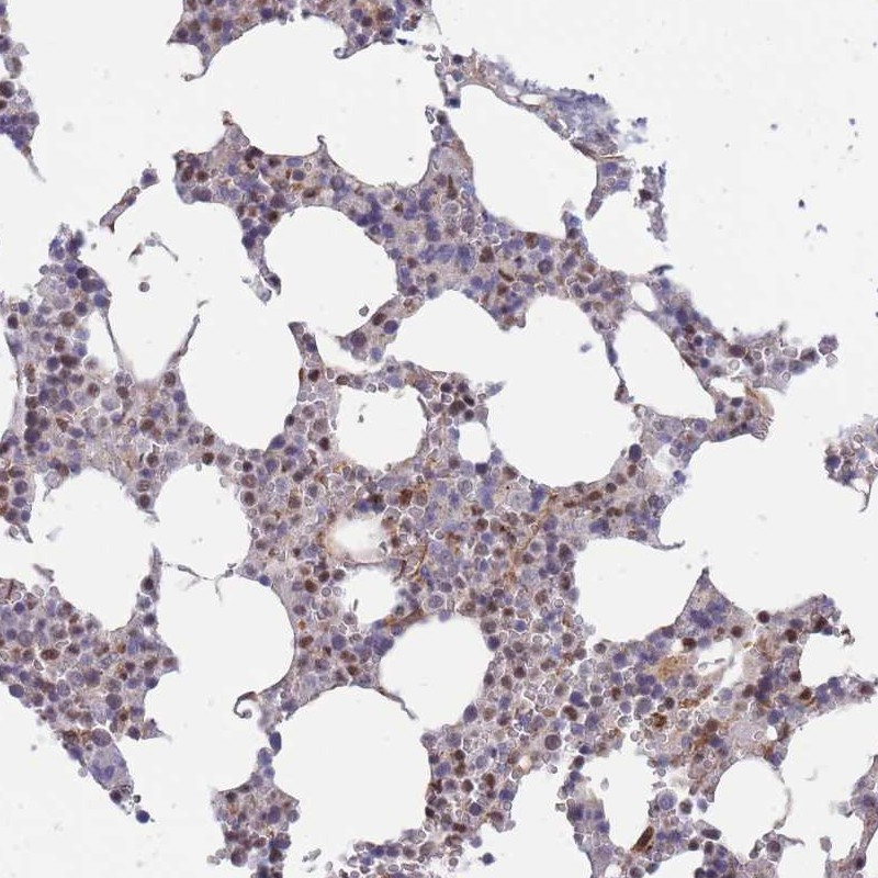 Immunohistochemical staining of human bone marrow shows nuclear positivity in hematopoietic cells.