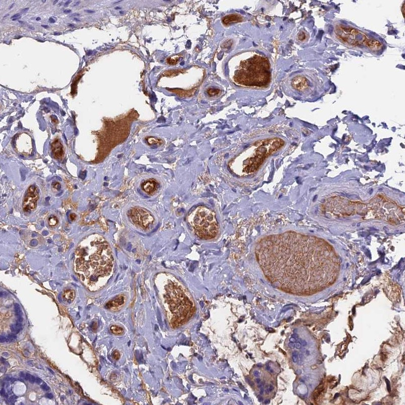 Immunohistochemical staining of plasma in human small intestine.