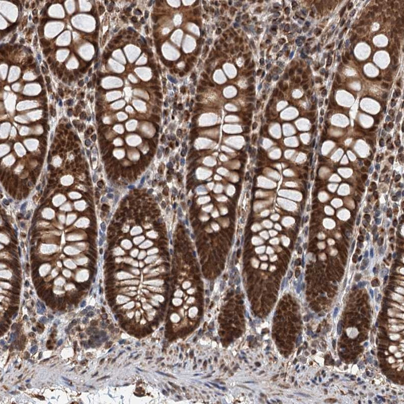 Immunohistochemical staining of human colon shows strong nuclear and cytoplasmic positivity in glandular cells.