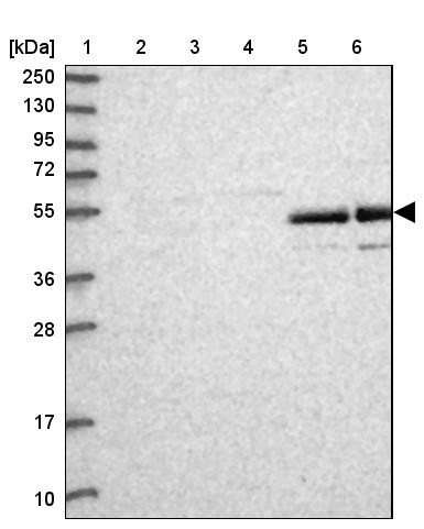 Lane 1: Marker [kDa] 250, 130, 95, 72, 55, 36, 28, 17, 10<br/>Lane 2: Human cell line RT-4<br/>Lane 3: Human cell line U-251MG sp<br/>Lane 4: Human plasma (IgG/HSA depleted)<br/>Lane 5: Human liver tissue<br/>Lane 6: Human tonsil tissue