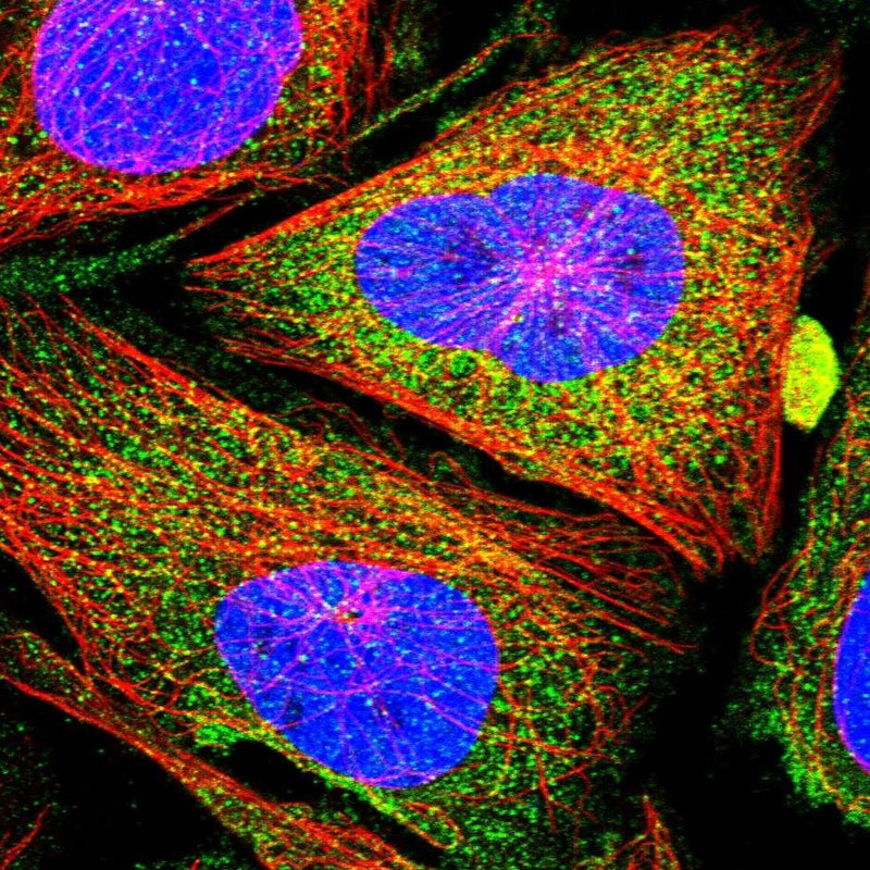 Immunofluorescent staining of human cell line U-2 OS shows localization to plasma membrane & cytosol.